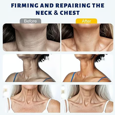 Reduces Wrinkles and Double Chin,Five Rollers for All Around Massage,Neck Firming Cream